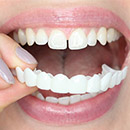 Snap-On-Smile